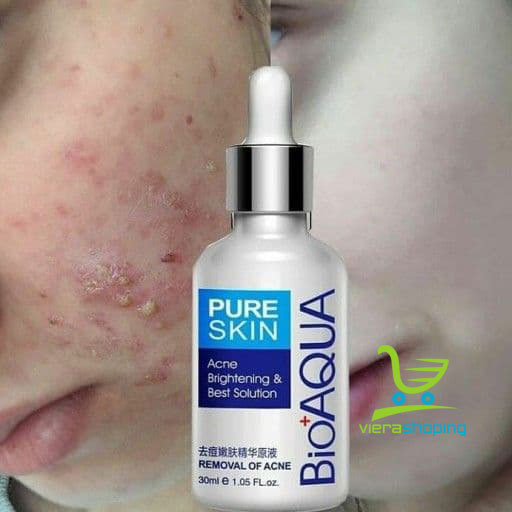 سرم درمانی ضدجوش و ترمیم کننده صورت بیوآکوا مدل PURE SKIN - تصویر 3